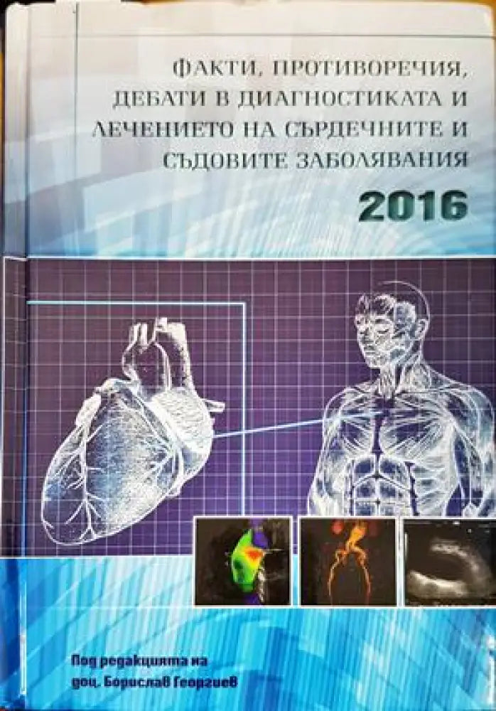 Факти, противоречия, дебати в диагностиката и лечението на сърдечните и съдовите заболявания 2016 (1247)