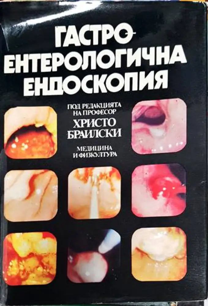 Гастроентерологична ендоскопия - Книга