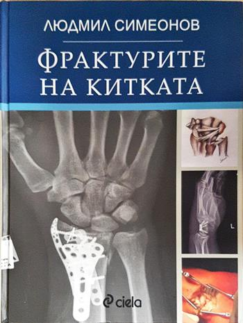 Фрактурите на китката (1865)