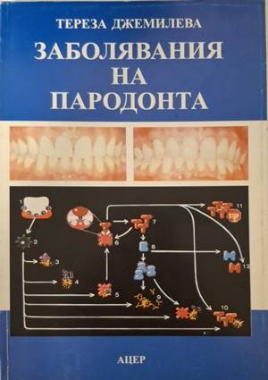 Заболявания на пародонта (1915)