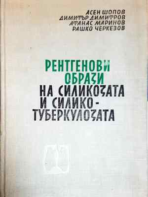 Рентгенови образи на силикозата и силикотуберкулозата (1798)