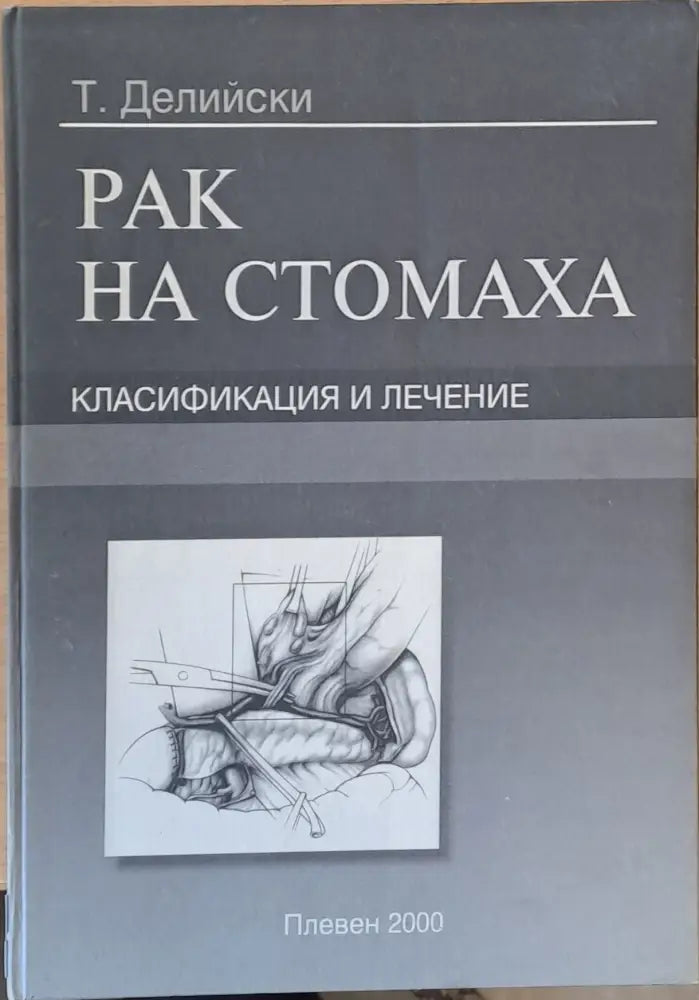 Рак на стомаха Класификация и лечение - Книги