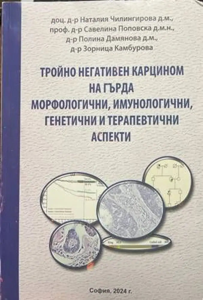 Тройно негативен карцином на гърда. Морфологични, имунологични, генетични и терапевтични аспекти (1133)