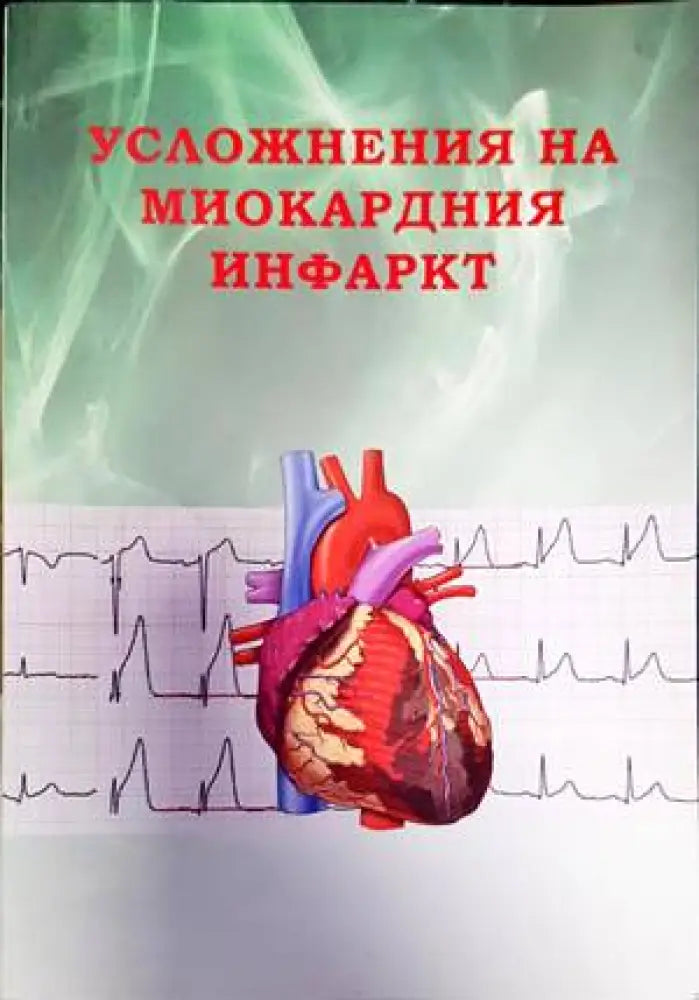 Усложнения на миокардния инфаркт - Книги