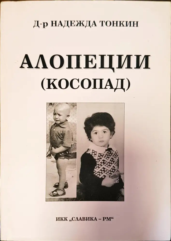 Алопеции косопат - Книги