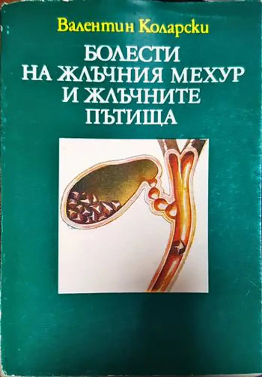 Болести на жлъчния мехур и жлъчните пътища - Книги
