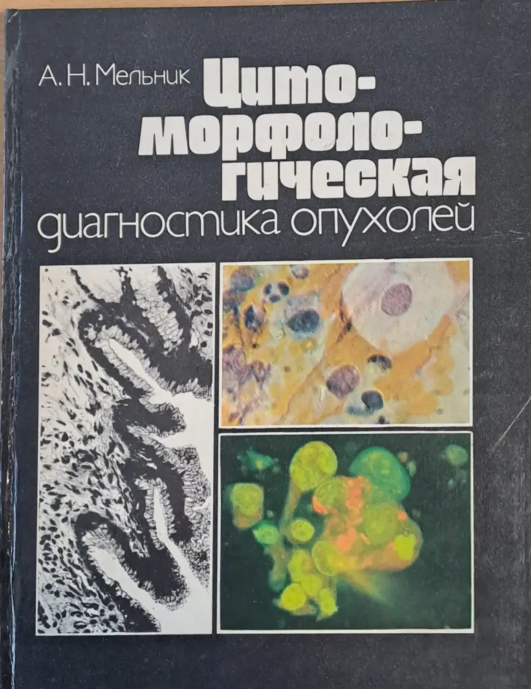 Цитоморфологическая диагностика опухолей - Книги