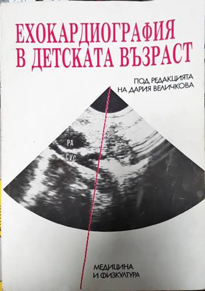 Ехокардиография в детската възраст - Книги