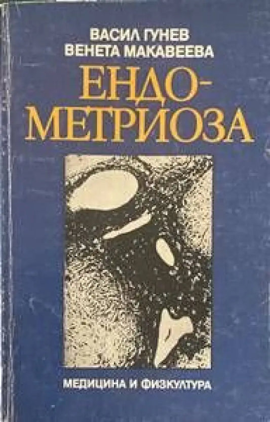 Ендометриоза - Книги