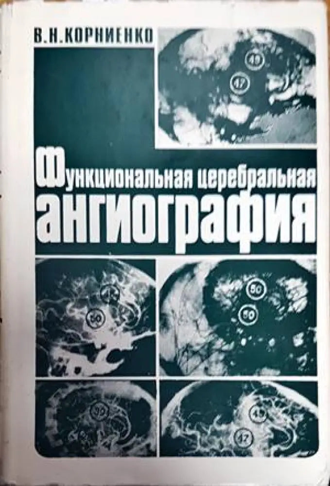 Функциональная церебральная ангиография - Книги
