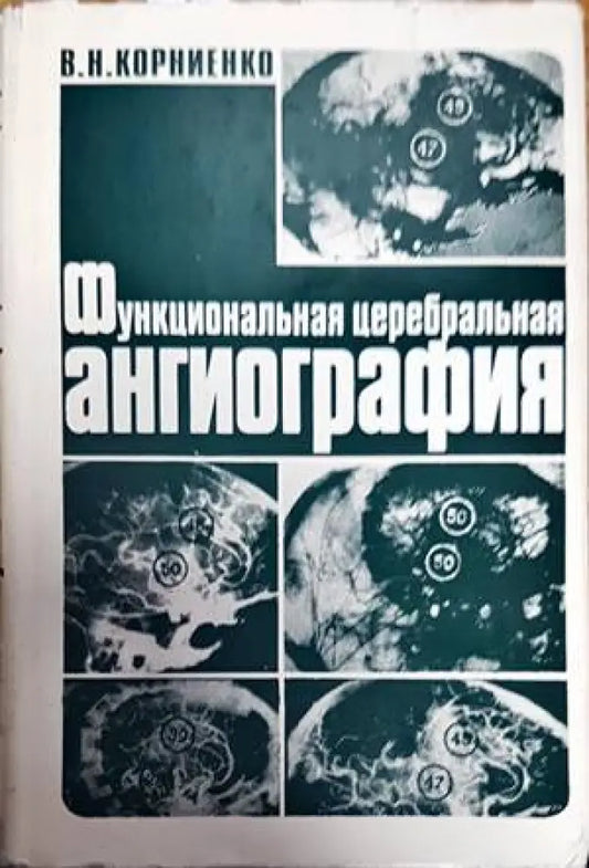 Функциональная церебральная ангиография - Книги