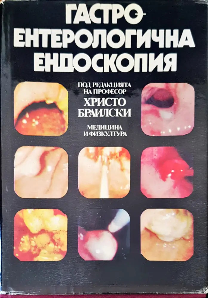 Гастро ентерологична ендоскопия - Книги