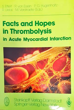 Facts and Hopes in Thrombolysis in Acute Myocardial Infarction