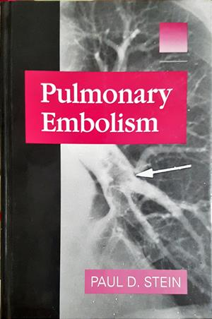Pulmonary Embolism - Paul D. Stein - корица