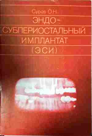 Эндо-субпериостальный имплантат - Суров О.Н.