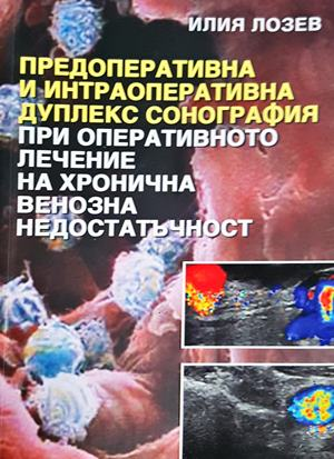Предоперативна и интраоперативна дуплекс сонография - корица