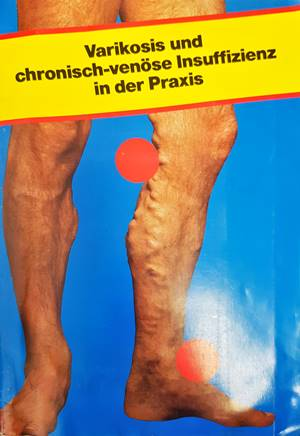 Varikosis und chronisch-venöse Insuffizienz in der Praxis - Hübner, Marshall