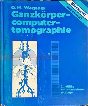 Ganzkörper-computertomographie – O. H. Wegener