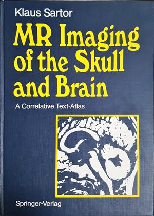 MR Imaging of the Skull and Brain – Klaus Sartor