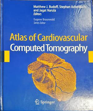 Atlas of Cardiovascular Computed Tomography – Budoff, Achenbach, Narula