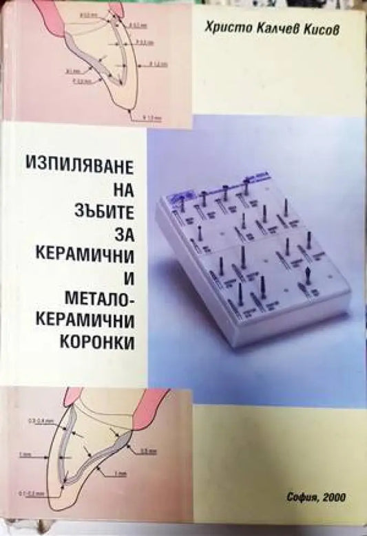 Изпиляване на зъбите за керамични и металокерамични коронки - Книги