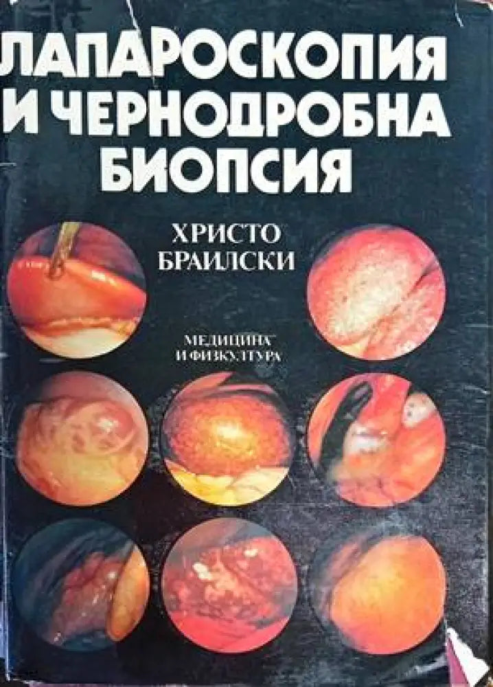 Лапароскопия и чернодробна биопсия - Книги