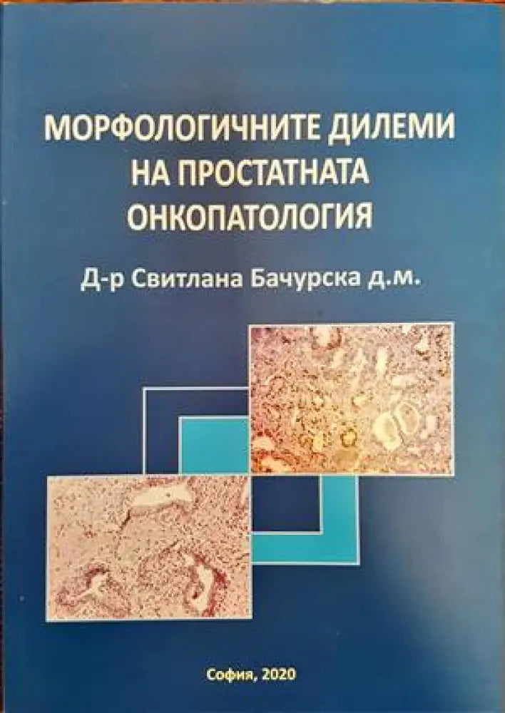 Морфологичните дилеми на простатната онкопатология - Книги