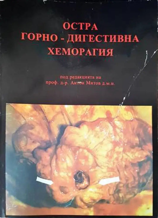 Остра горно-дигестивна хеморагия - Книги