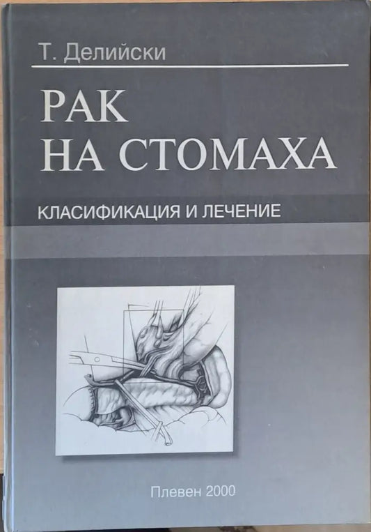 Рак на стомаха Класификация и лечение - Книги