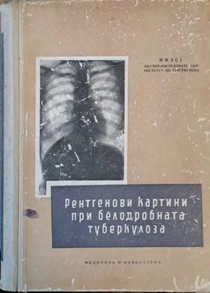 Рентгенови картини при белодробната туберкулоза (791) - Книга
