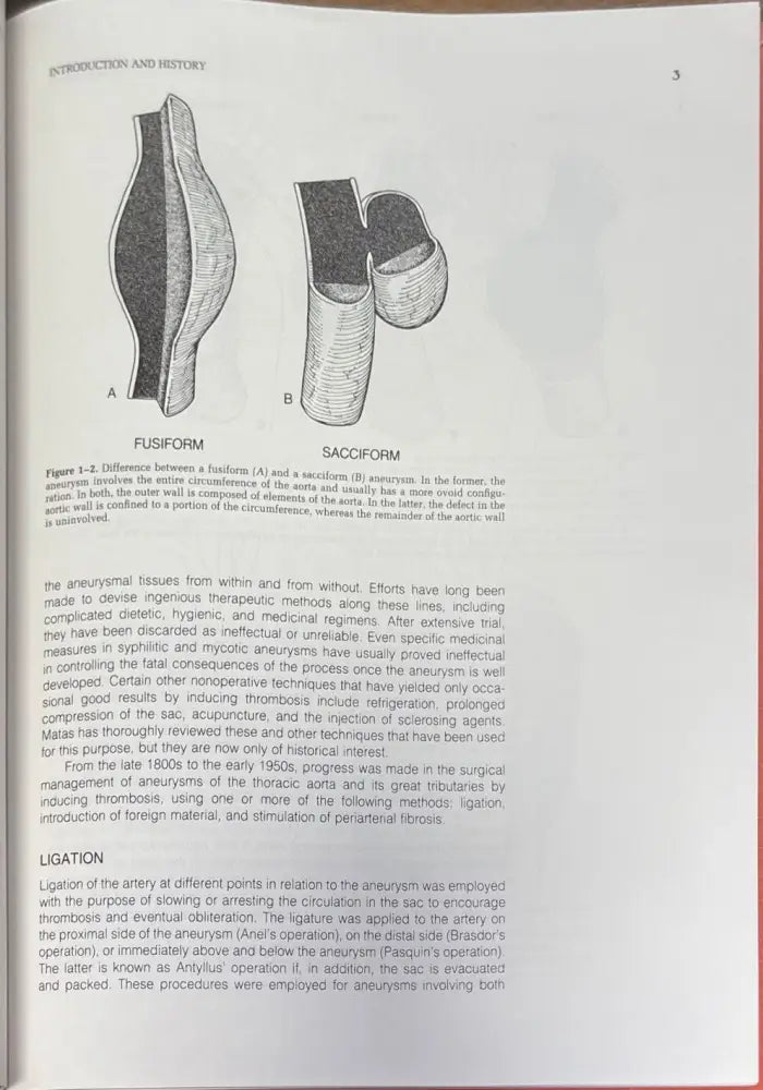 Surgical treatment of aortic aneurysms - Книги