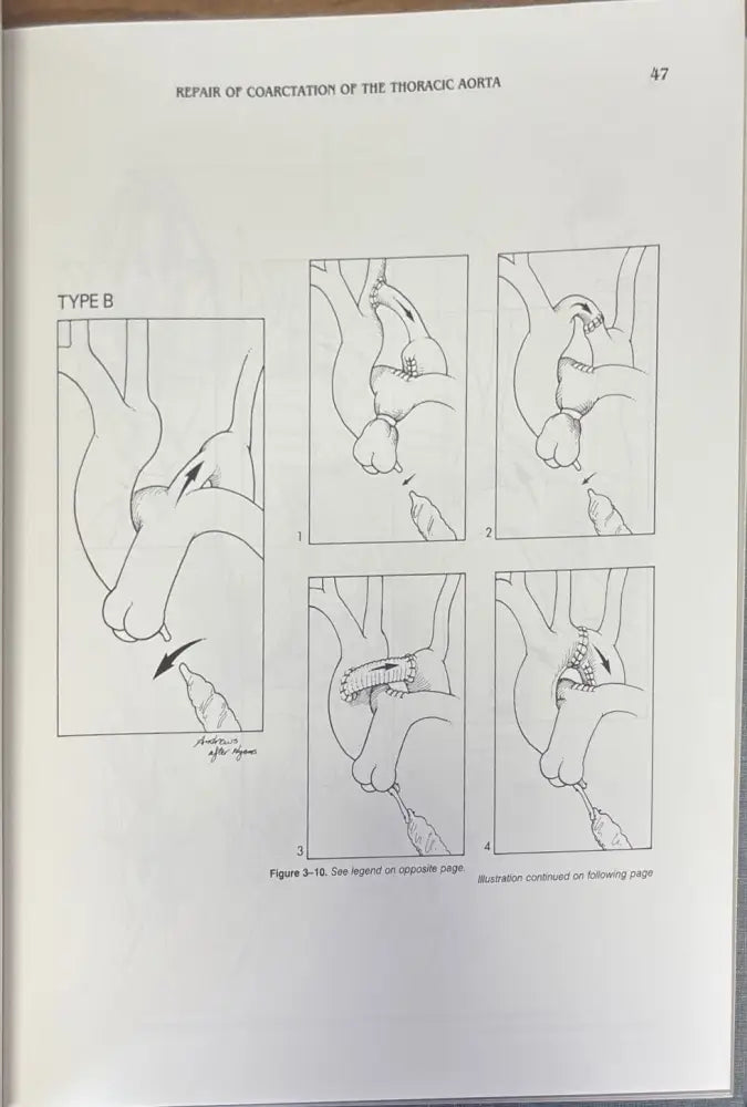 Techniques in cardiac surgery. Second edition - Книги