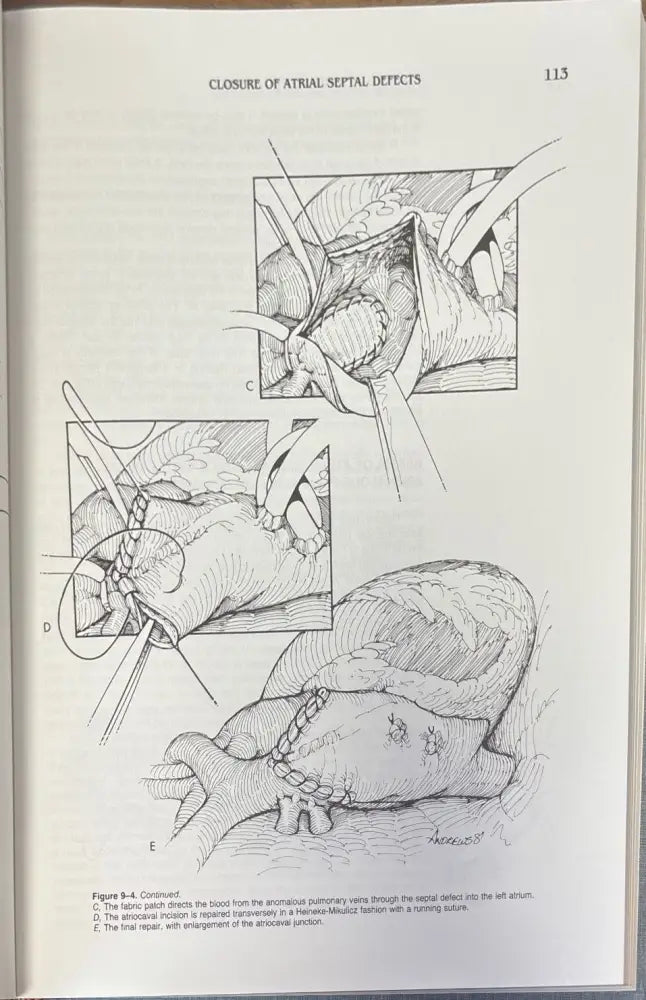 Techniques in cardiac surgery. Second edition - Книги