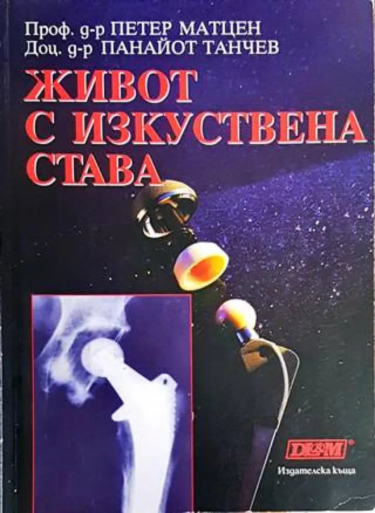 Живот с изкуствена става (1340) - Книга